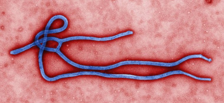 Wirus Eboli - Fot. CDC / Cynthia Goldsmith
