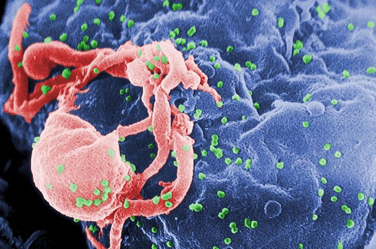 Wirus HIV - Fot. CDC / Cynthia Goldsmith
