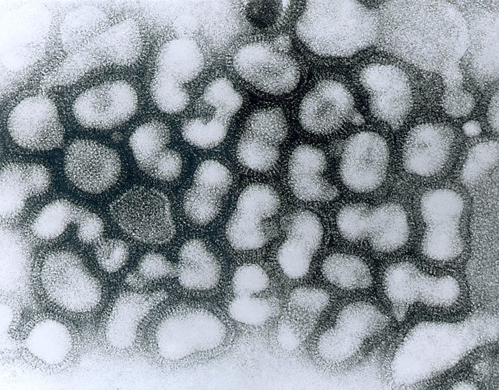 Wirus Ptasiej Grypy - Fot. CDC / dr Erskine Palmer